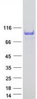 Human ANKS3 Protein (Recombinant Myc-DDK (Flag))