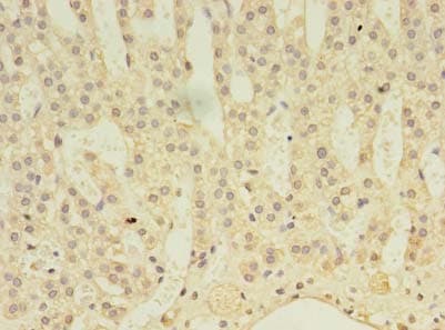 ABLIM3 Antibody