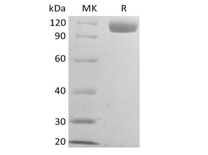 Mouse CD22 Protein (Recombinant 6His, C-terminus)