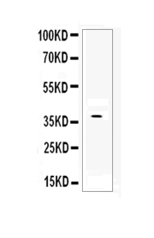 Polyclonal Rabbit anti-Human DKK1 Antibody (WB)