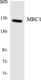 Polyclonal Rabbit anti-Human Mannose Receptor / CD206 Antibody (aa626-675, WB)