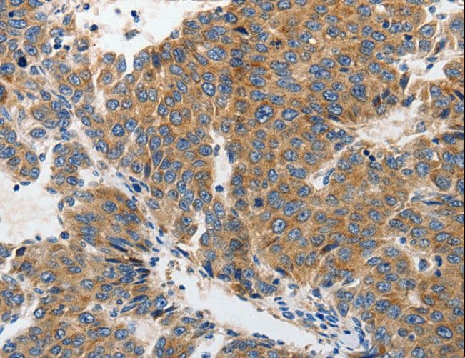 Polyclonal Rabbit anti-Human GRIA2 / GLUR2 Antibody (IHC)