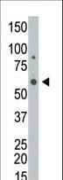 GALK2 Antibody (aa404-434)