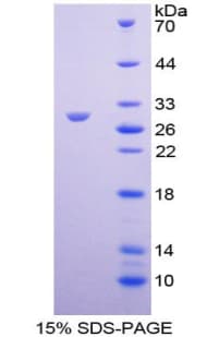 Bovine SDC1 / Syndecan 1 / CD138 Protein (Recombinant His-T7)