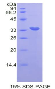 Mouse CDK7 Protein (Recombinant His)