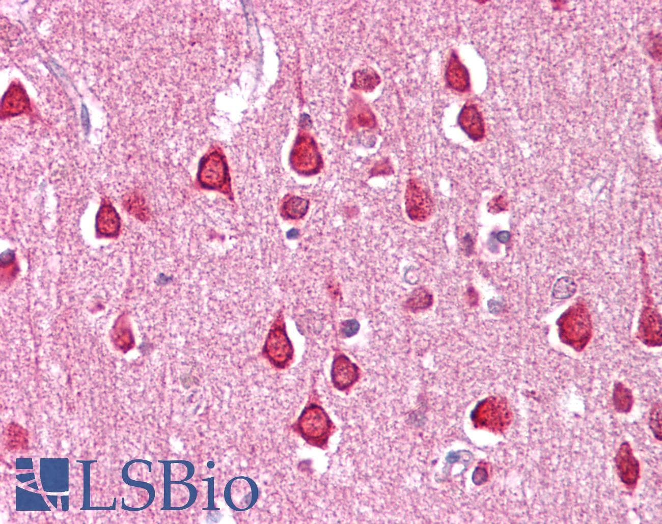 SLC18A1 / VMAT1 Antibody (C-Terminus)