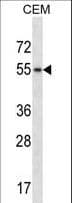 HCK Antibody (aa72-101)