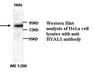Polyclonal Rabbit anti-Human HYAL1 Antibody (Internal, IHC, WB)