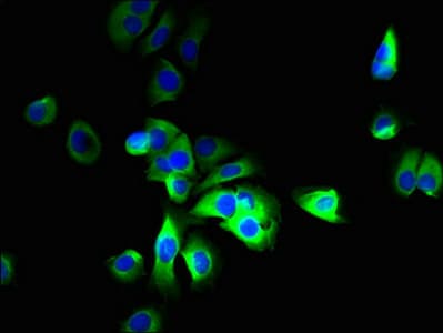 SLC12A9 / CIP1 Antibody