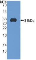 ITGB5 / Integrin Beta 5 Antibody (aa137-378)