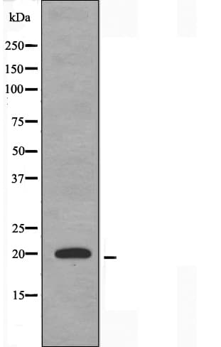 PPP1R14C / KEPI Antibody