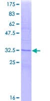 Human CD81 Protein (Recombinant GST, N-terminus)