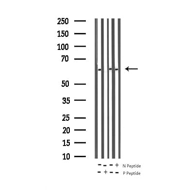 RELA / NFKB p65 Antibody (phospho-Ser311)