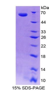 Mouse INHBE / Activin Protein (Recombinant His-GST)