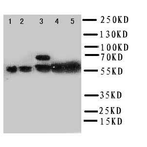 Polyclonal Rabbit anti-Human PTGS2 / COX2 / COX-2 Antibody (aa589-604, IHC, WB)