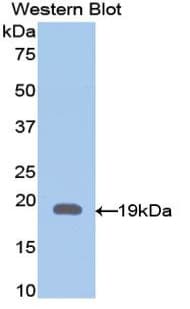 GFAP Antibody (aa113-211)