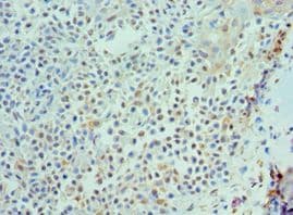 Polyclonal Rabbit anti-Human IL21 Antibody (aa25-162, IHC)