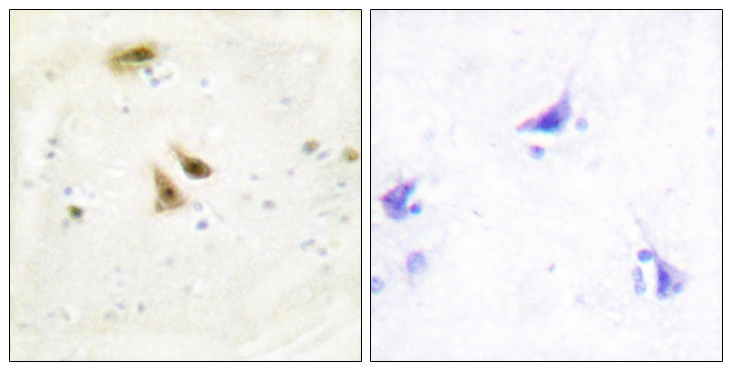 UBTF / UBF Antibody