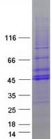 Human TOB2 Protein (Recombinant Myc-DDK (Flag))