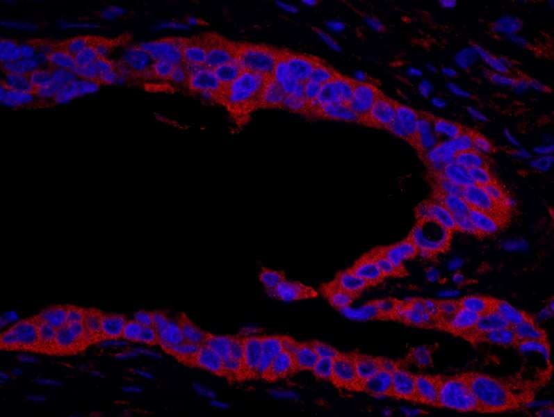 RPS6KA1 / RSK1 Antibody (aa375-425)