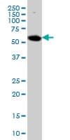Monoclonal Mouse anti-Human AKT1 Antibody (clone 6D6, WB)
