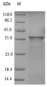 Mosquito D7 Protein (Recombinant 6His, N-terminus)