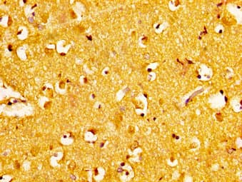 NAT10 Antibody