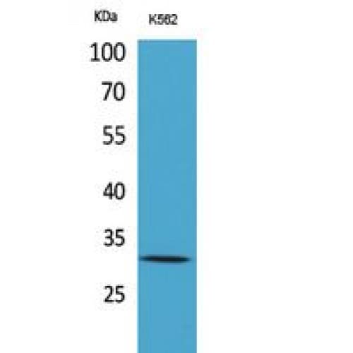 Polyclonal Rabbit anti-Human VDAC1 / PORIN Antibody (1-50 aa, N-terminal, WB)