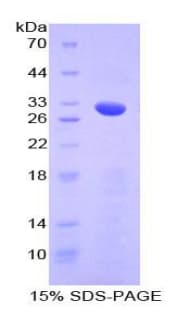 Mouse NUMB Protein (Recombinant His-T7)
