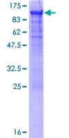 Human CEACAM5 / CD66e Protein (Recombinant GST)