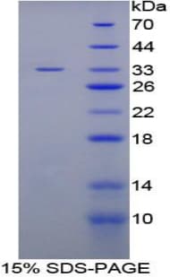 Human ITIH4 Protein (Recombinant 6His, N-terminus)