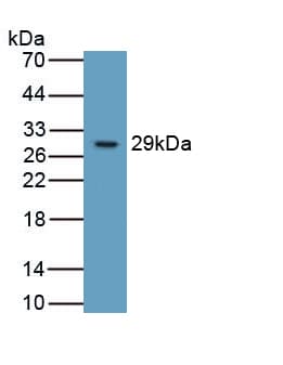ITGB6 / Integrin Beta 6 Antibody (PE)