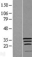 WIBG Protein (Over-Expression Lysate Myc-DDK (Flag))