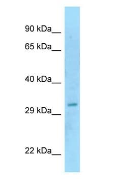 SAP30BP / HTRG Antibody (N-Terminus)