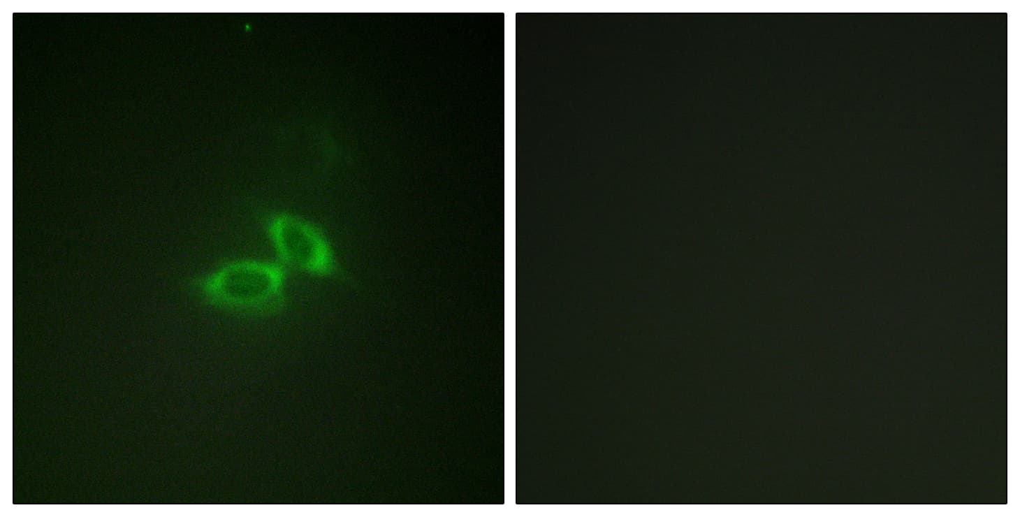 Polyclonal Rabbit anti-Human GRIN1 / NMDAR1 Antibody (aa856-905, IHC, IF, WB)