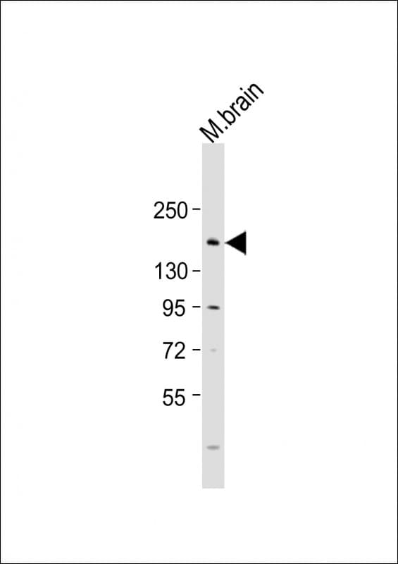 GRIN2B / NMDAR2B / NR2B Antibody (aa1300-1332)