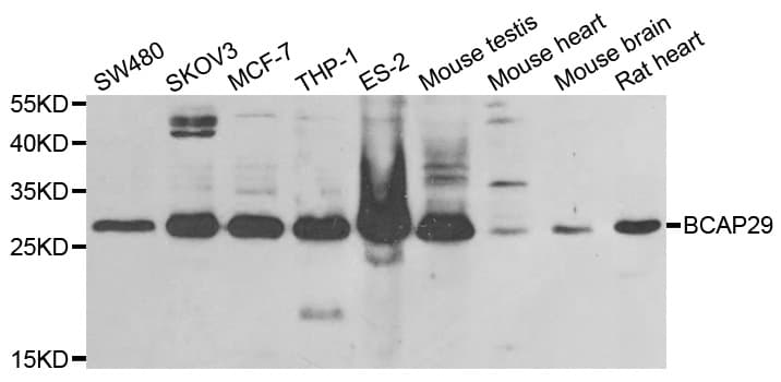 Polyclonal Rabbit anti-Human BAP29 / BCAP29 Antibody (IHC, WB)