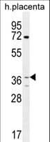 OR2AT4 Antibody (aa275-303)