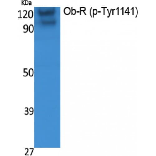 LEPR / Leptin Receptor Antibody (1080-1160 aa)