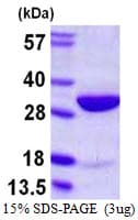 Human HMG2 / HMGB2 Protein (Recombinant His)