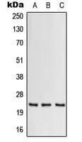 Polyclonal Rabbit anti-Human CSF2 / GM-CSF Antibody (C-Terminus, WB)