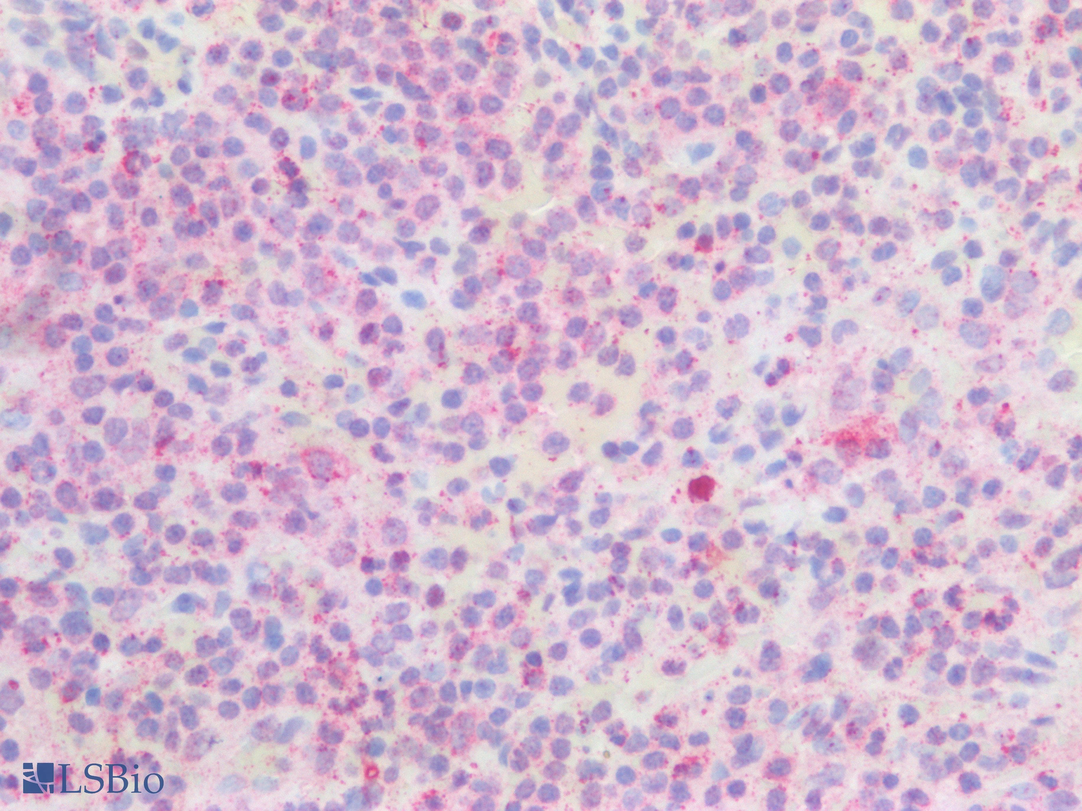 PLCB2 Antibody