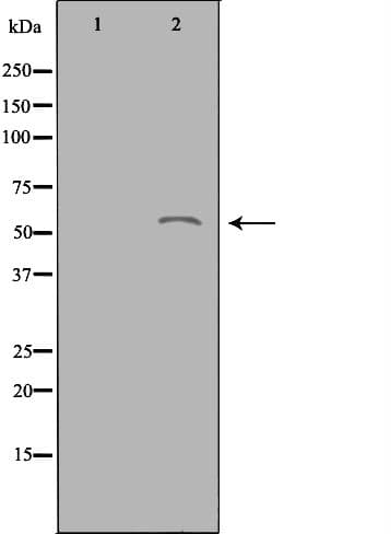 ACOT2 Antibody
