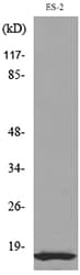 Polyclonal Rabbit anti-Human IL-1B / IL-1 Beta Antibody (WB)