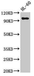 Polyclonal Rabbit anti-Human SUV420H1 Antibody (WB)
