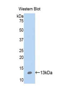 S100A10 Antibody (aa1-96)