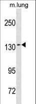 SEC31A / HSPC275 Antibody (aa473-502)