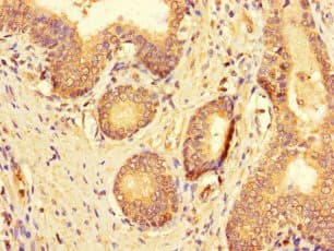 C19orf44 Antibody