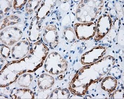LIPG / Endothelial Lipase Antibody (clone OTI4C3)