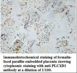PLCXD1 Antibody (aa106-323)